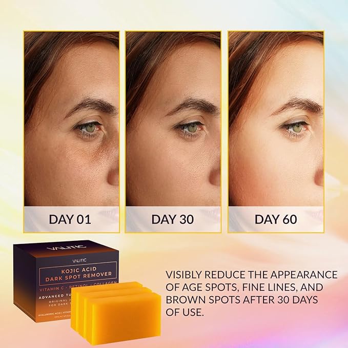 VALITIC Kojic Acid Dark Spot Corrector Soap Bars with Vitamin C, Retinol, Collagen, Turmeric - Original Japanese Complex - Hyaluronic Acid, Vitamin E, Shea Butter, Castile Olive Oil - 3 Pack With Bag