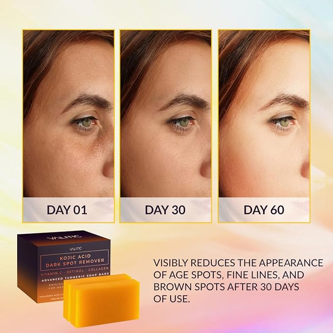 VALITIC Kojic Acid Dark Spot Corrector Soap Bars with Vitamin C, Retinol, Collagen, Turmeric - Original Japanese Complex - Hyaluronic Acid, Vitamin E, Shea Butter, Castile Olive Oil - 2 Pack With Bag